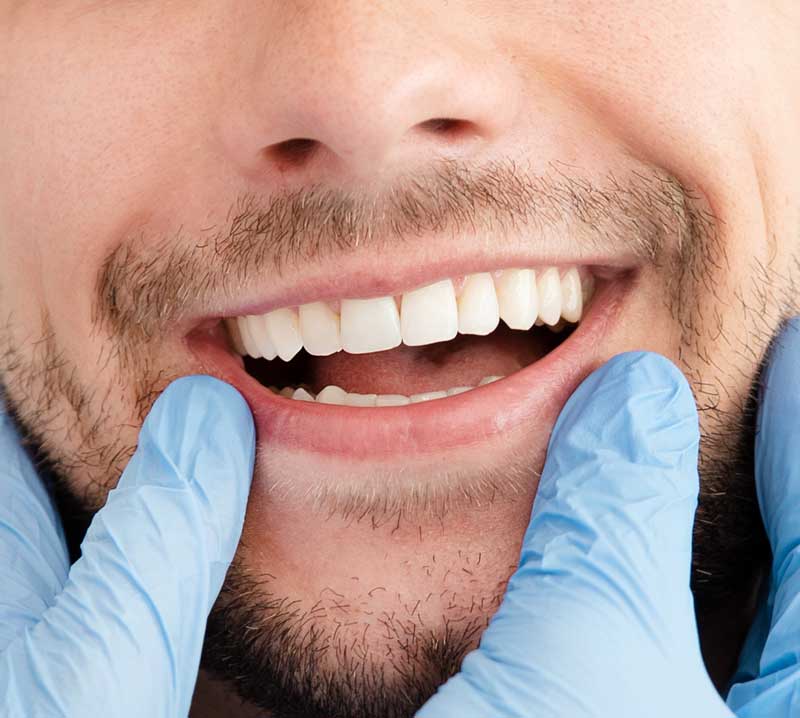 tratamiento periodontitis