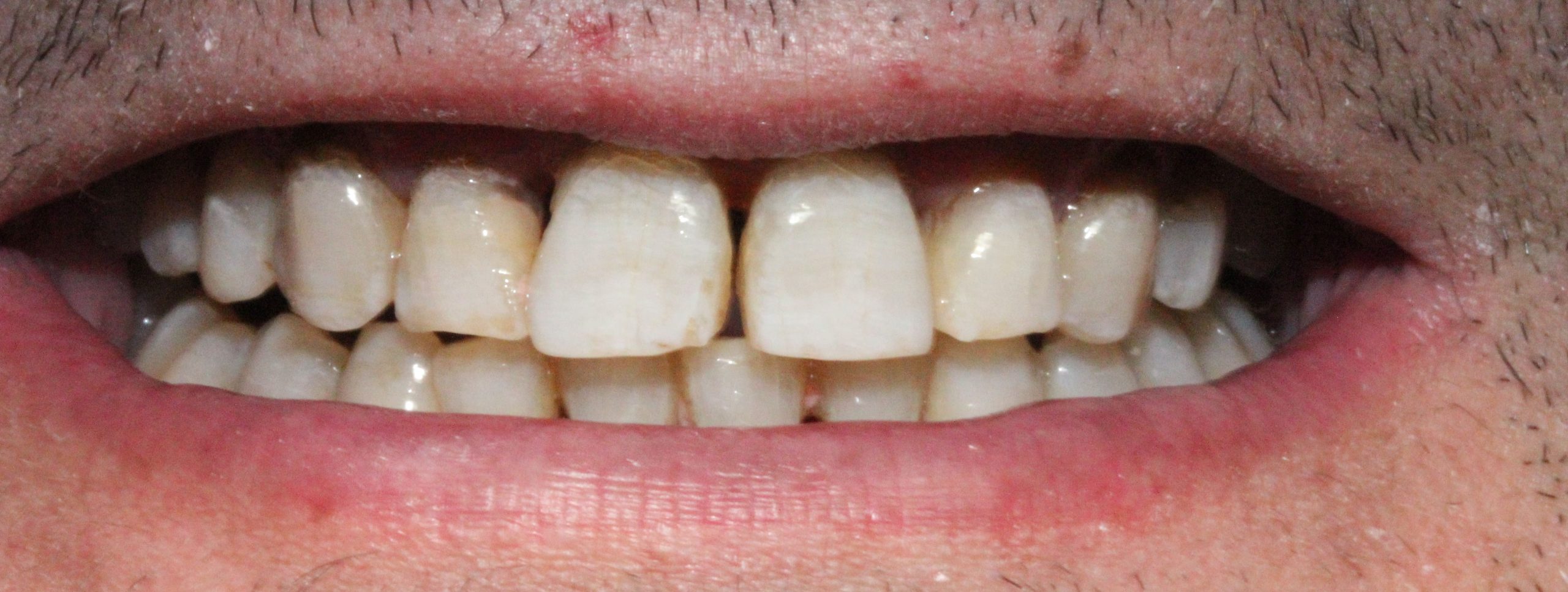 Ortodoncia Felip