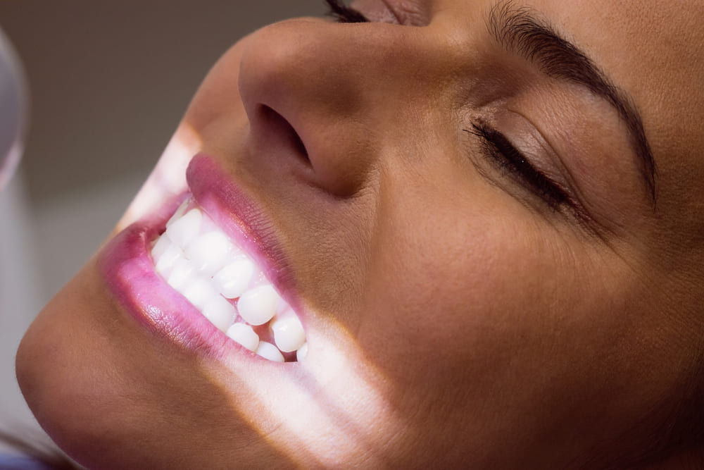 selladores dentales