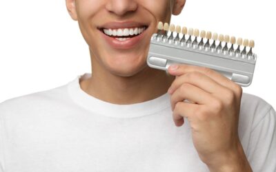 Manteniment de carilles dentals: guia pràctica perquè durin més