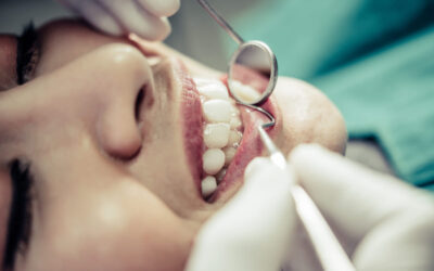 Per què sagnen les genives? Causes, solucions i quan cal preocupar-se
